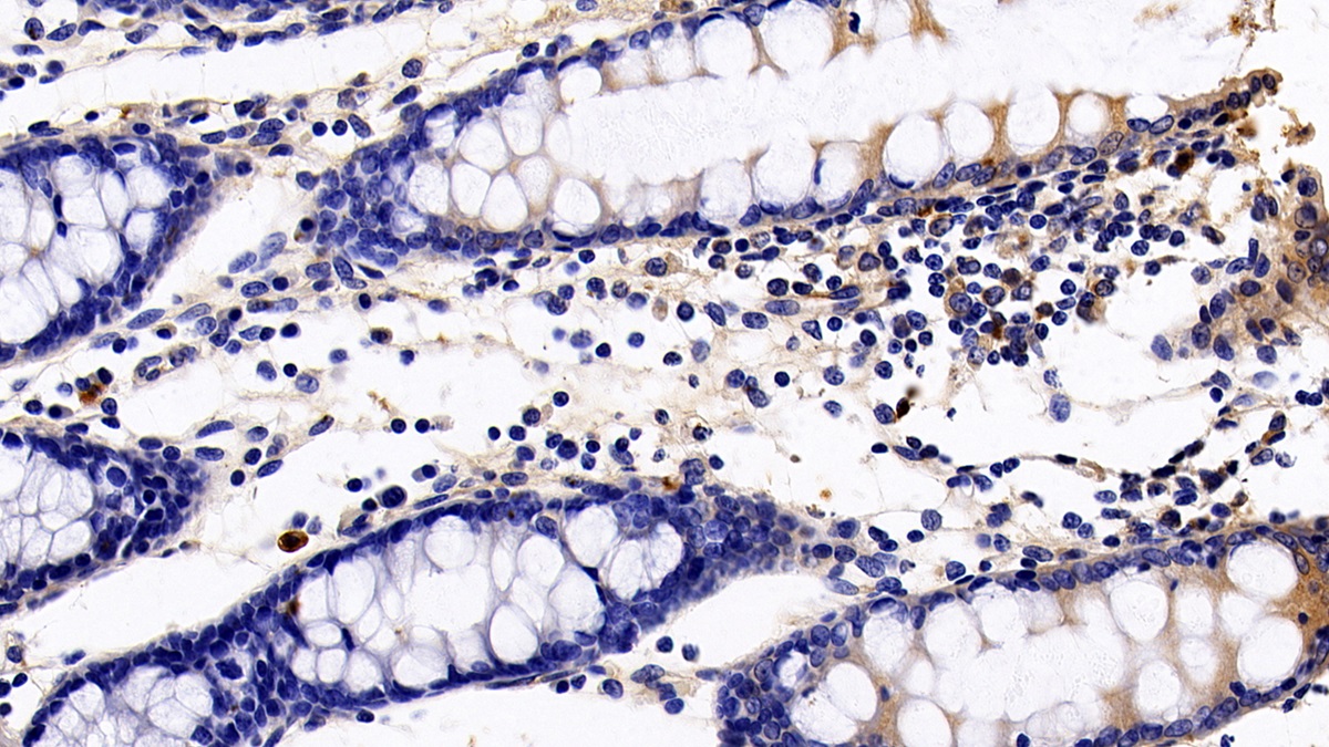 Monoclonal Antibody to Sialic Acid Binding Ig Like Lectin 7 (SIGLEC7)