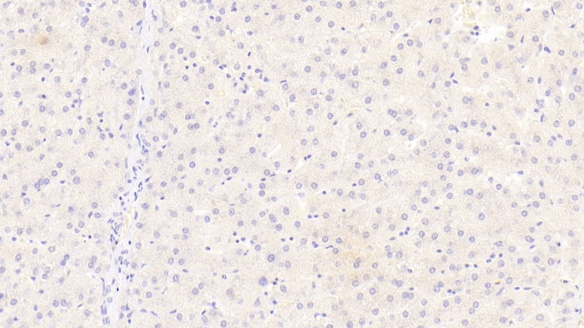 Monoclonal Antibody to Sialic Acid Binding Ig Like Lectin 8 (SIGLEC8)