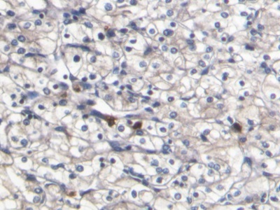 Monoclonal Antibody to S100 Calcium Binding Protein A8 (S100A8)