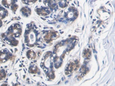 Monoclonal Antibody to S100 Calcium Binding Protein A8 (S100A8)