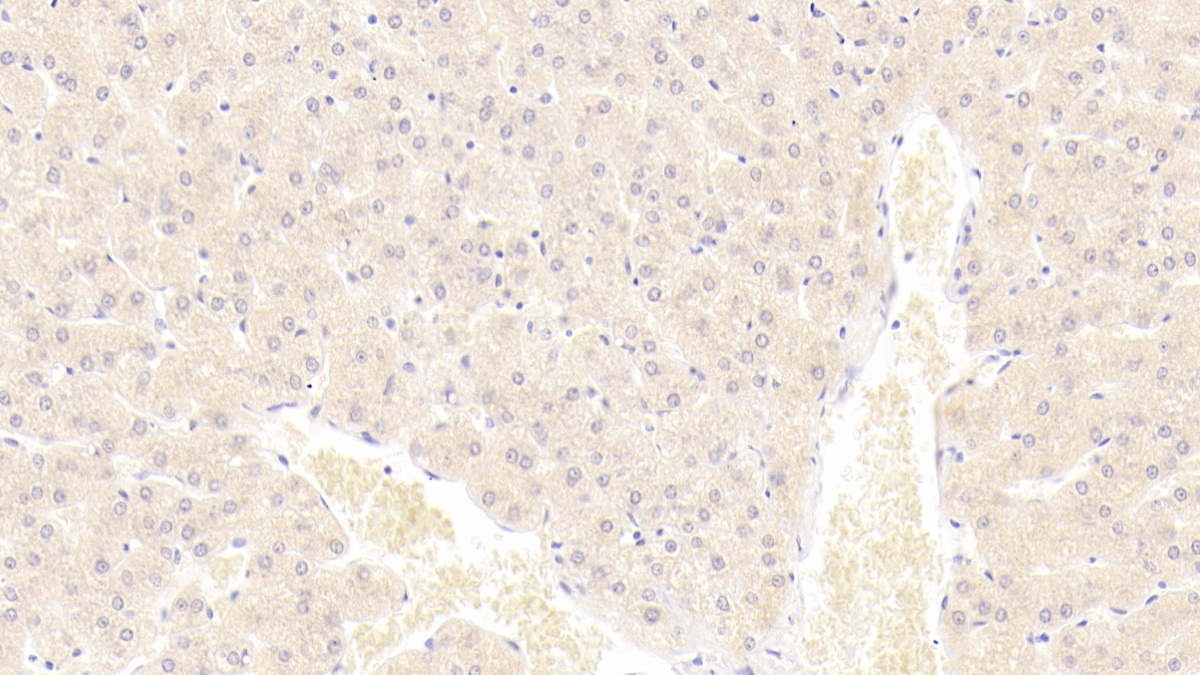 Monoclonal Antibody to S100 Calcium Binding Protein A9 (S100A9)