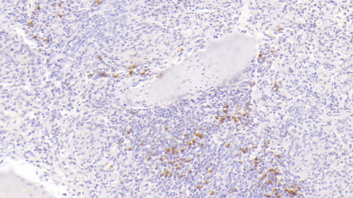 Monoclonal Antibody to S100 Calcium Binding Protein A9 (S100A9)