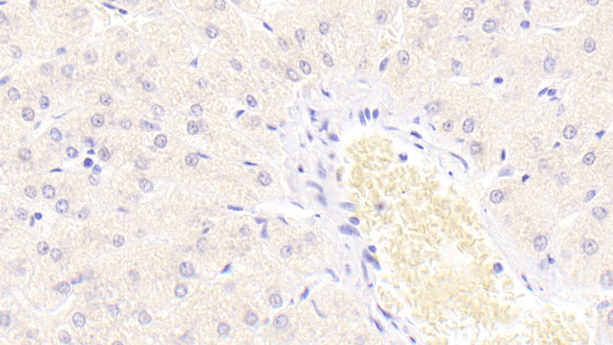 Monoclonal Antibody to S100 Calcium Binding Protein A9 (S100A9)