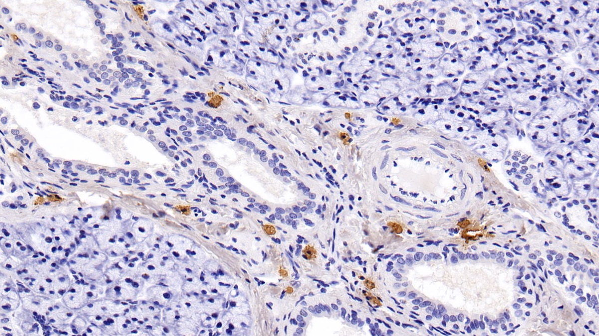 Monoclonal Antibody to S100 Calcium Binding Protein A9 (S100A9)