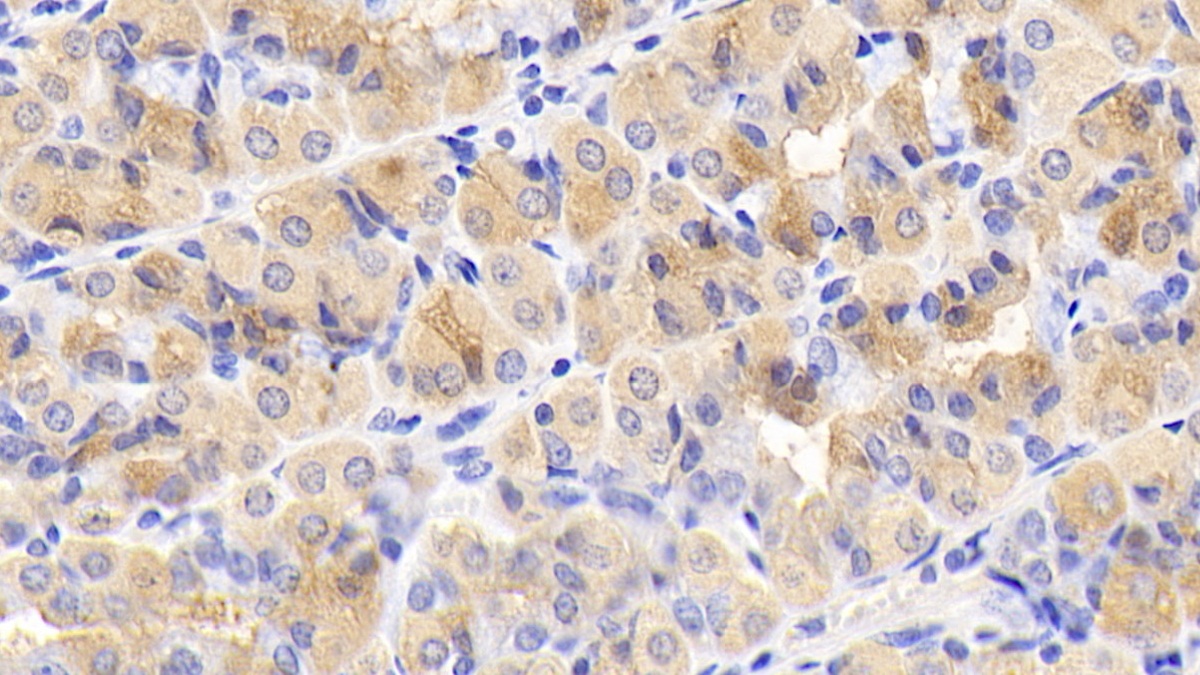 Monoclonal Antibody to Serine/threonine-protein kinase mTOR (mTOR)