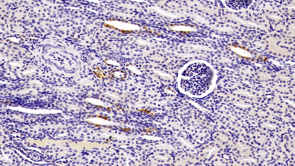 Monoclonal Antibody to Selenoprotein P1, Plasma (SEPP1)