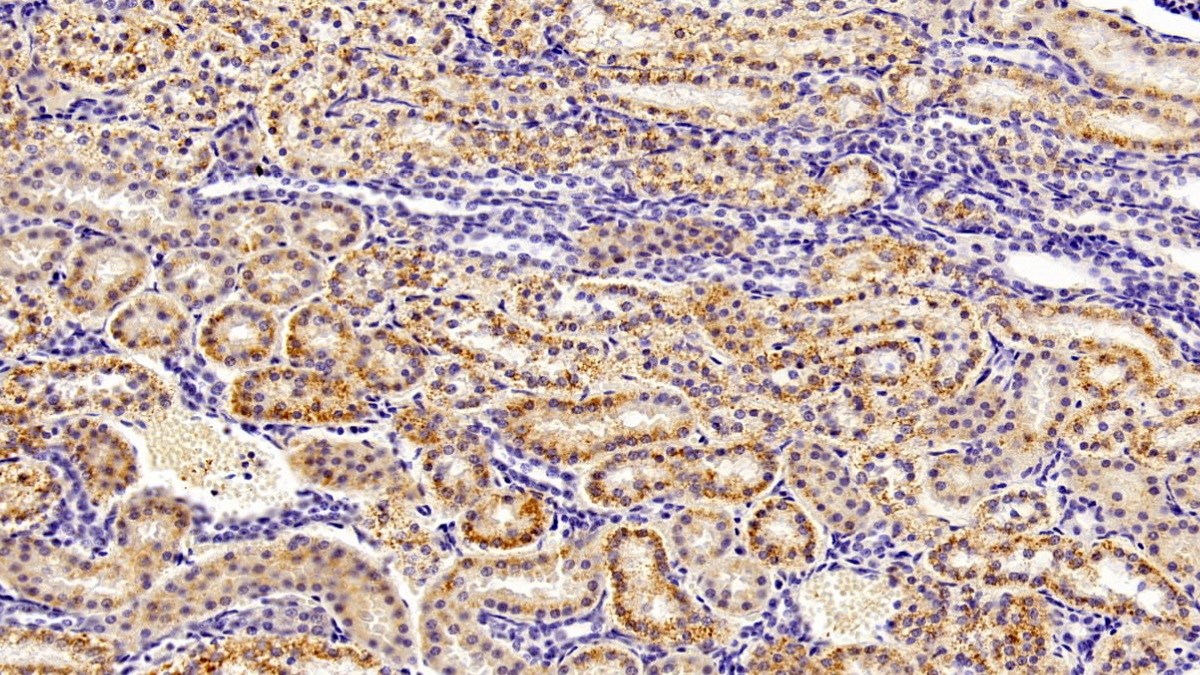 Monoclonal Antibody to Selenoprotein P1, Plasma (SEPP1)