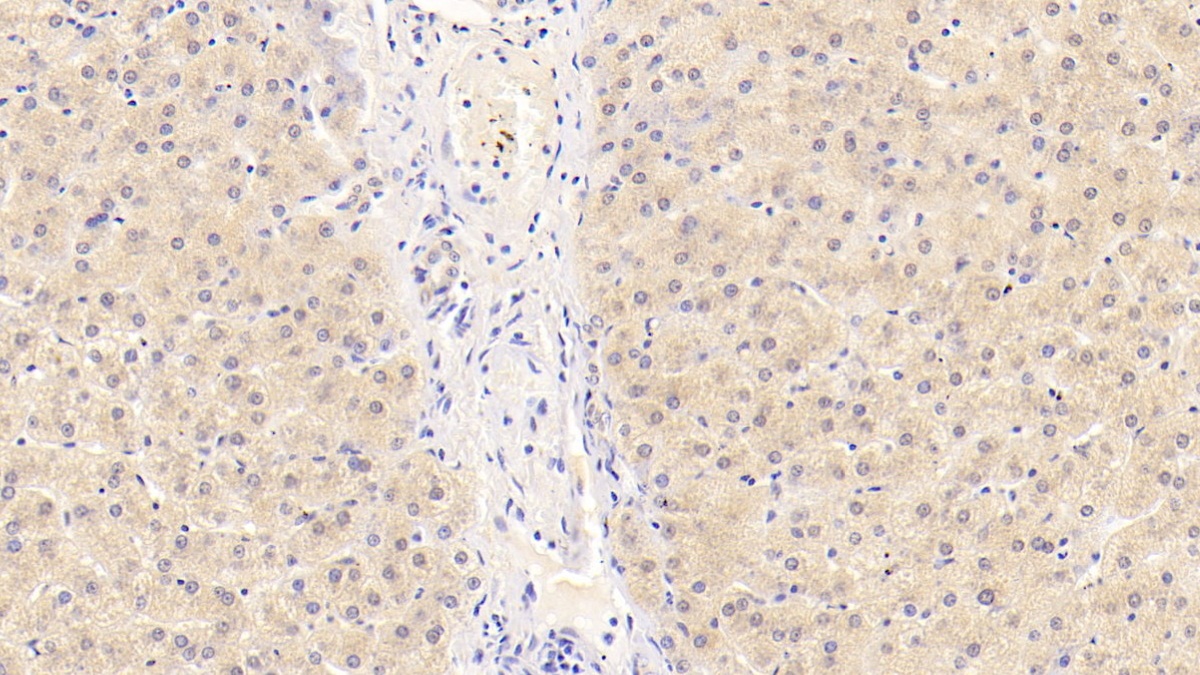 Monoclonal Antibody to Vitamin D Binding Protein (DBP)