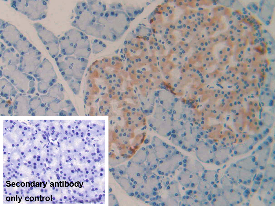 Monoclonal Antibody to Vitamin D Binding Protein (DBP)