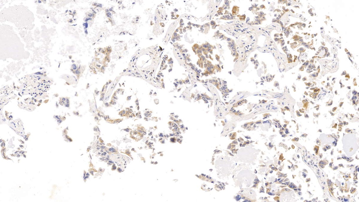 Monoclonal Antibody to Cytokeratin 17 (CK17)