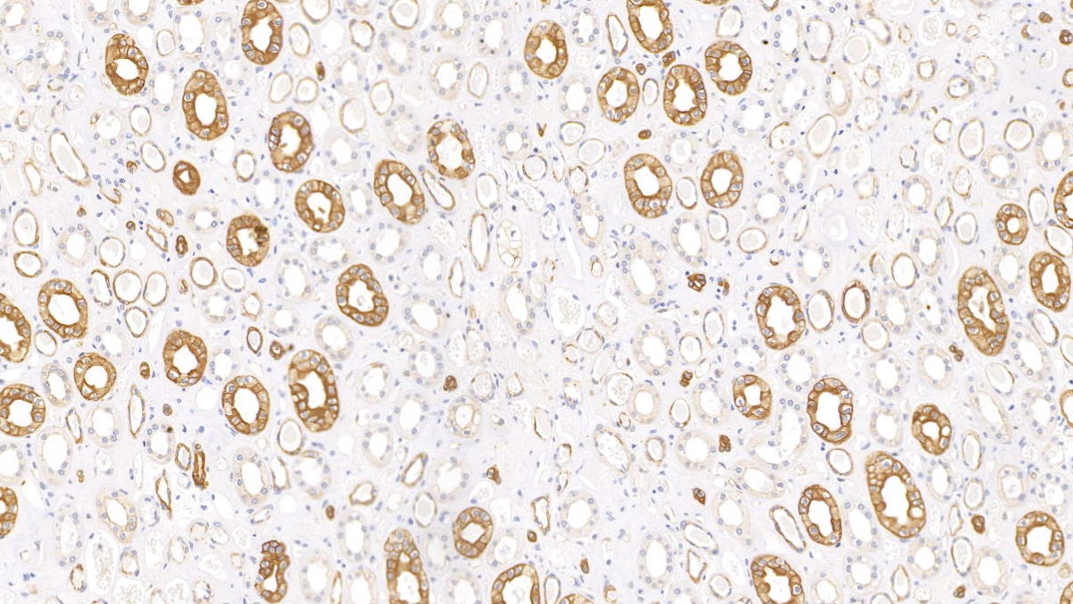 Monoclonal Antibody to Cytokeratin 17 (CK17)