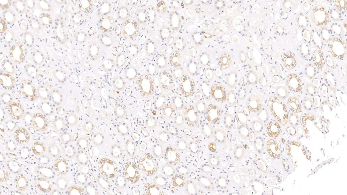 Monoclonal Antibody to Cytokeratin 17 (CK17)