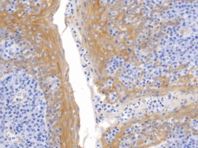 Monoclonal Antibody to Cytokeratin 17 (CK17)