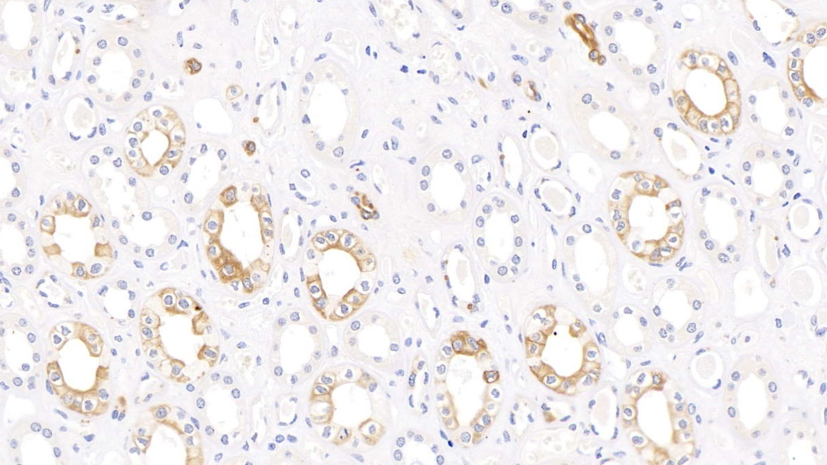 Monoclonal Antibody to Cytokeratin 17 (CK17)