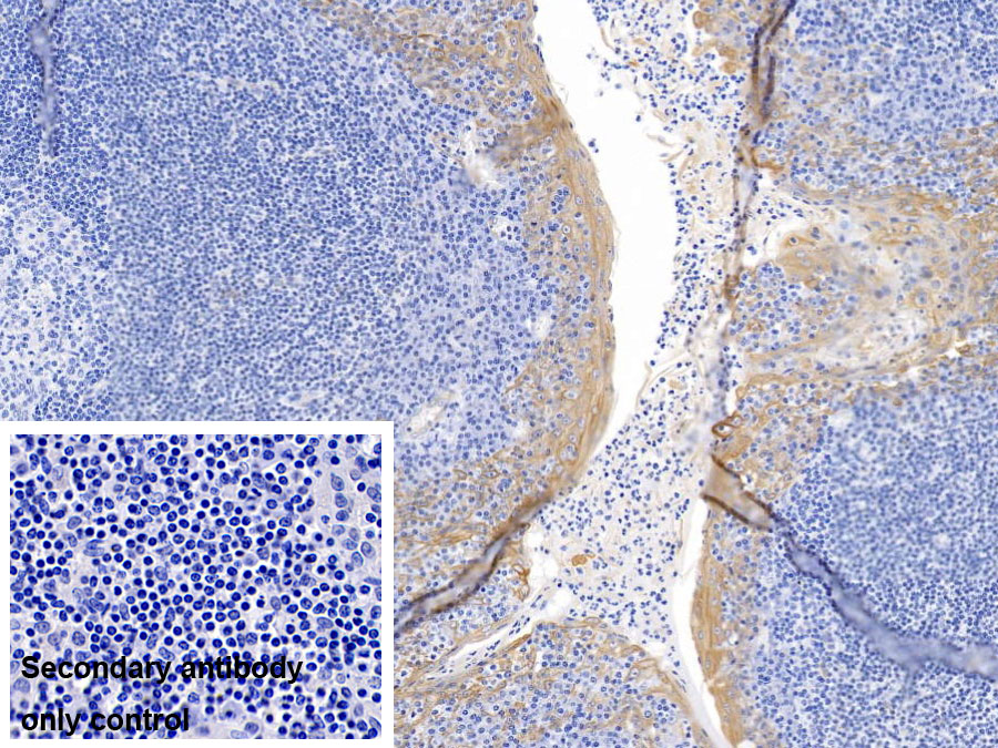 Monoclonal Antibody to Cytokeratin 17 (CK17)