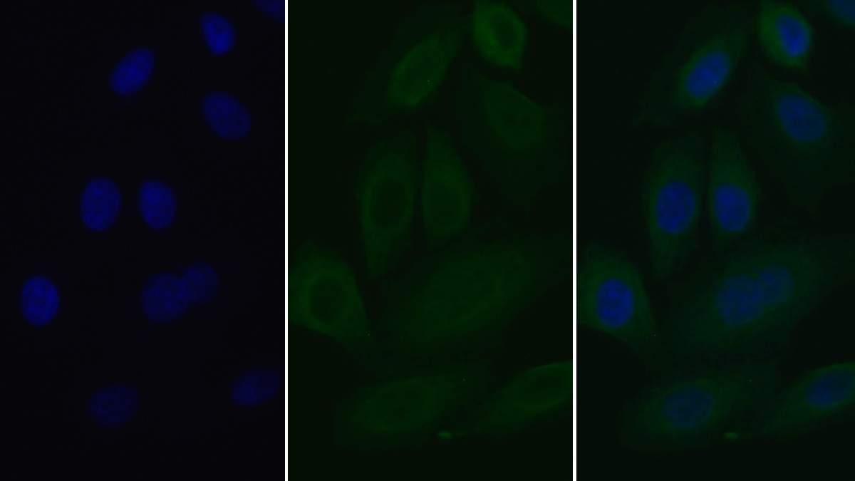 Monoclonal Antibody to Interleukin 2 Receptor Alpha (IL2Ra)