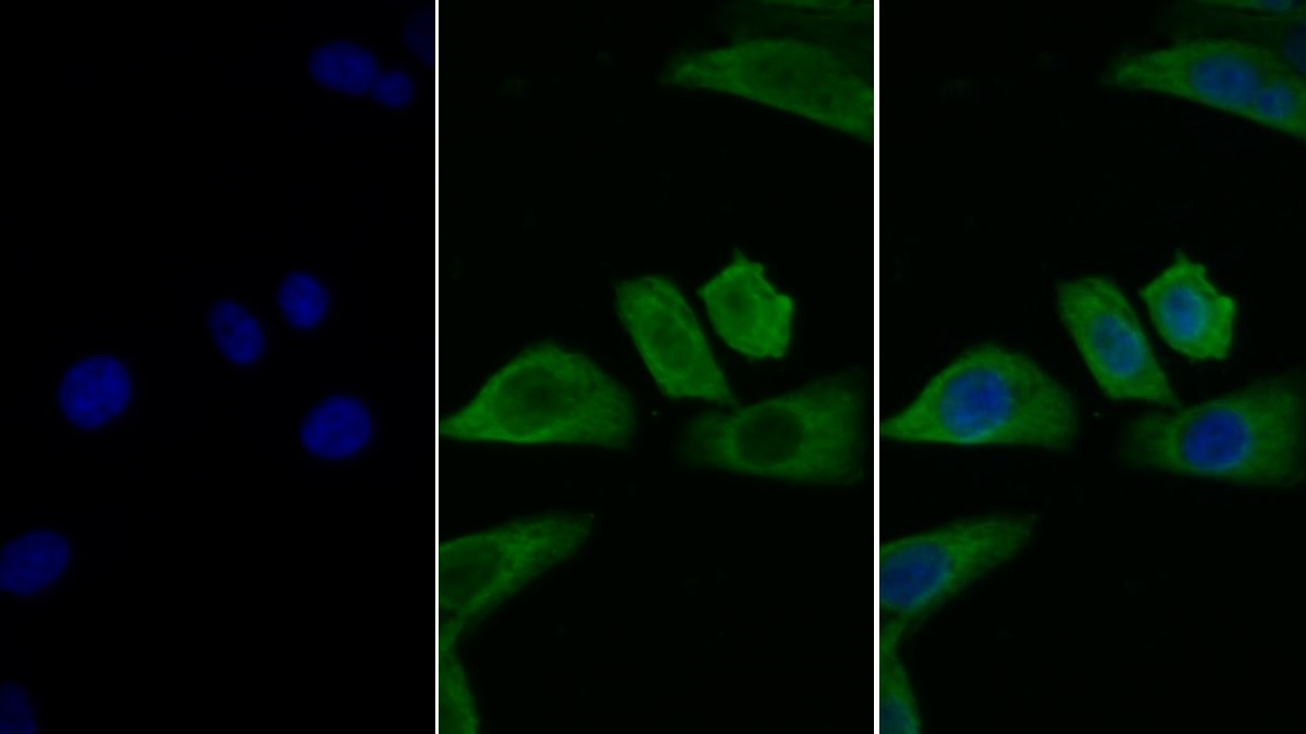 Monoclonal Antibody to Interleukin 2 Receptor Alpha (IL2Ra)