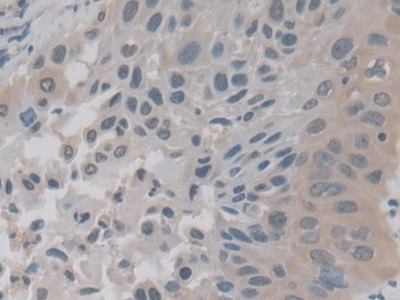 Monoclonal Antibody to Vascular Endothelial Growth Factor 121 (VEGF121)