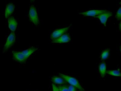 Monoclonal Antibody to Tubulin Beta (TUBb)