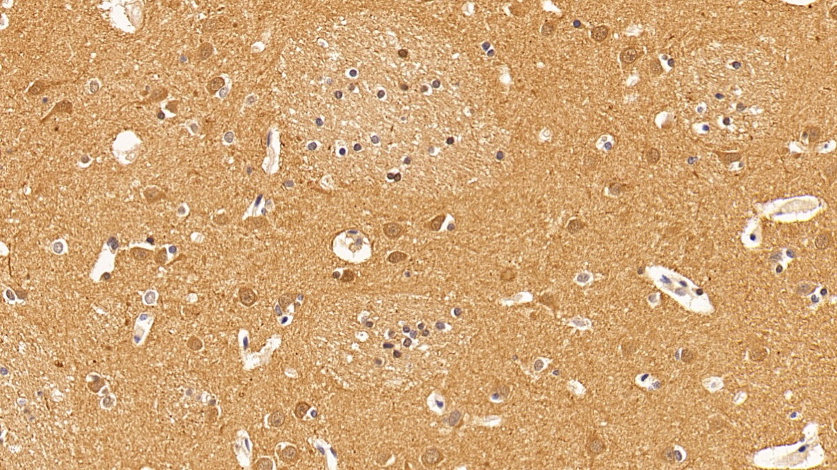 Monoclonal Antibody to Tubulin Beta (TUBb)