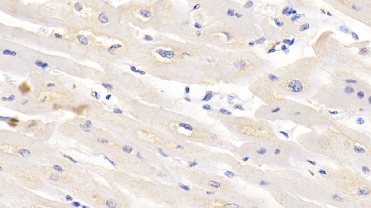 Monoclonal Antibody to Tubulin Beta (TUBb)