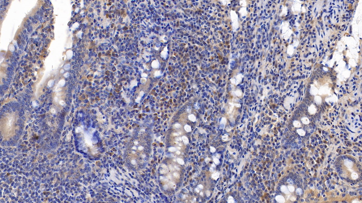 Monoclonal Antibody to Cluster Of Differentiation 3d (CD3d)