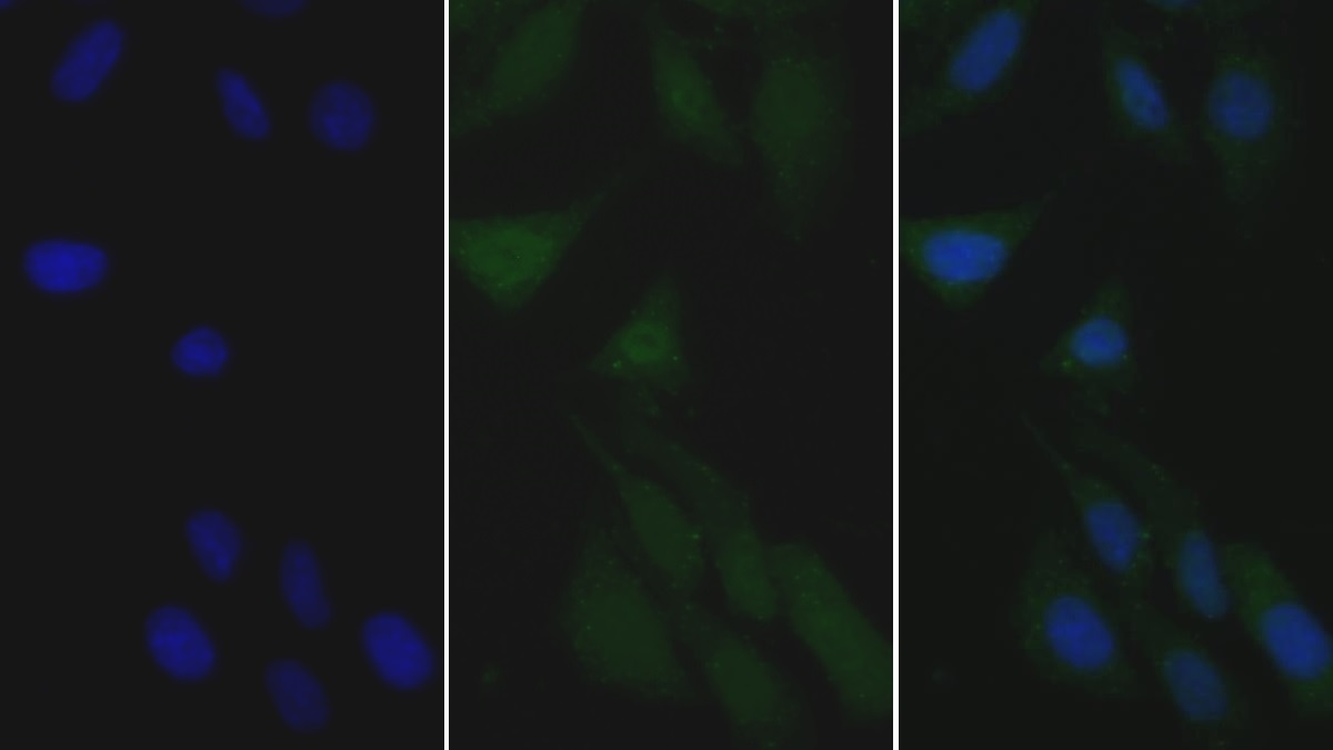 Monoclonal Antibody to Apolipoprotein B48 (APOB48)