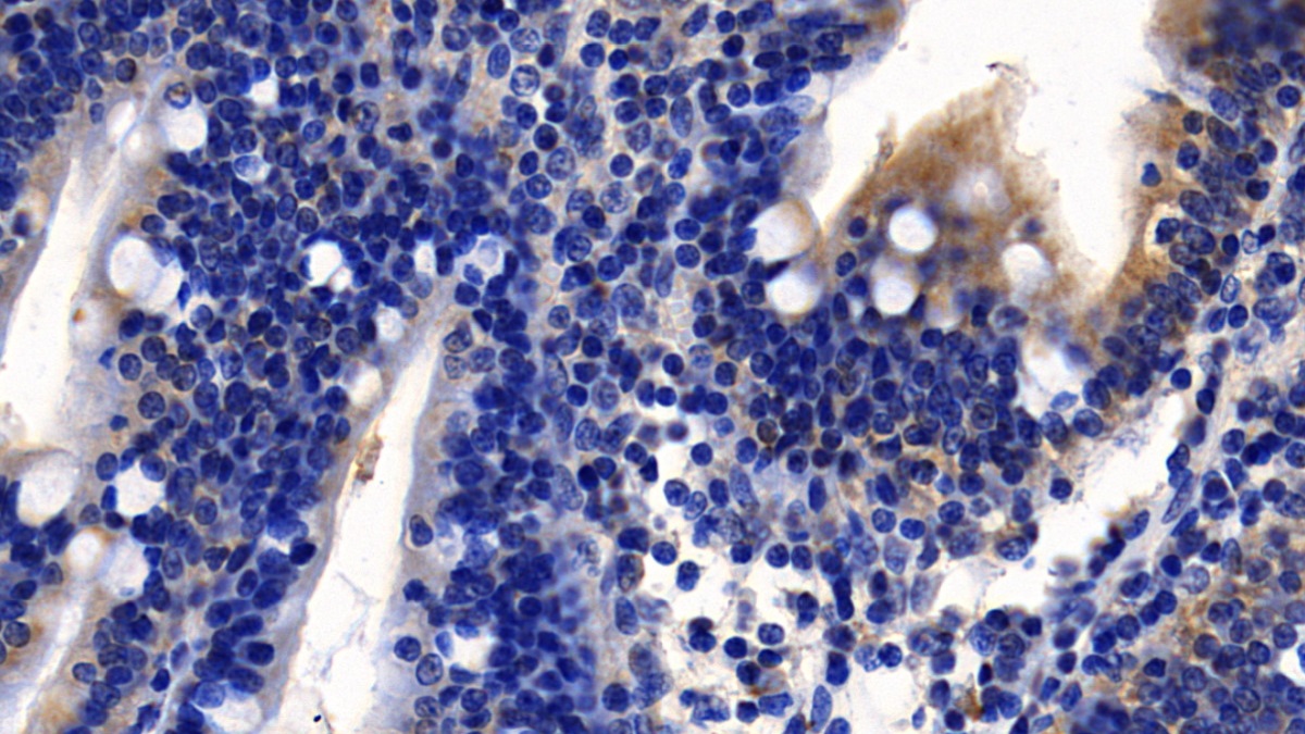 Monoclonal Antibody to Angiotensin I Converting Enzyme 2 (ACE2)