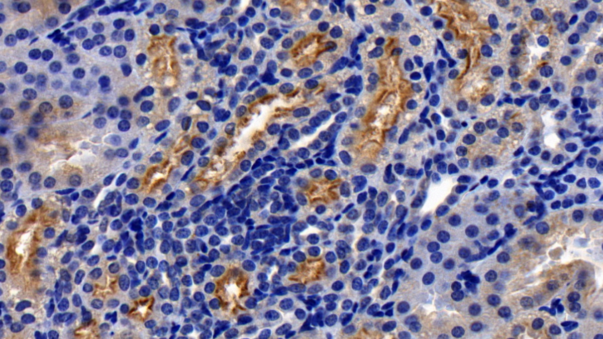 Monoclonal Antibody to Angiotensin I Converting Enzyme 2 (ACE2)