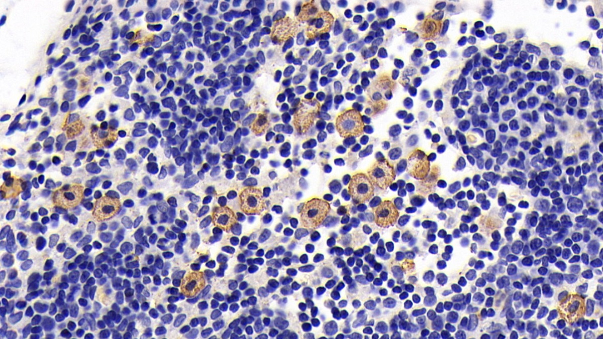 Monoclonal Antibody to Interleukin 7 Receptor (IL7R)