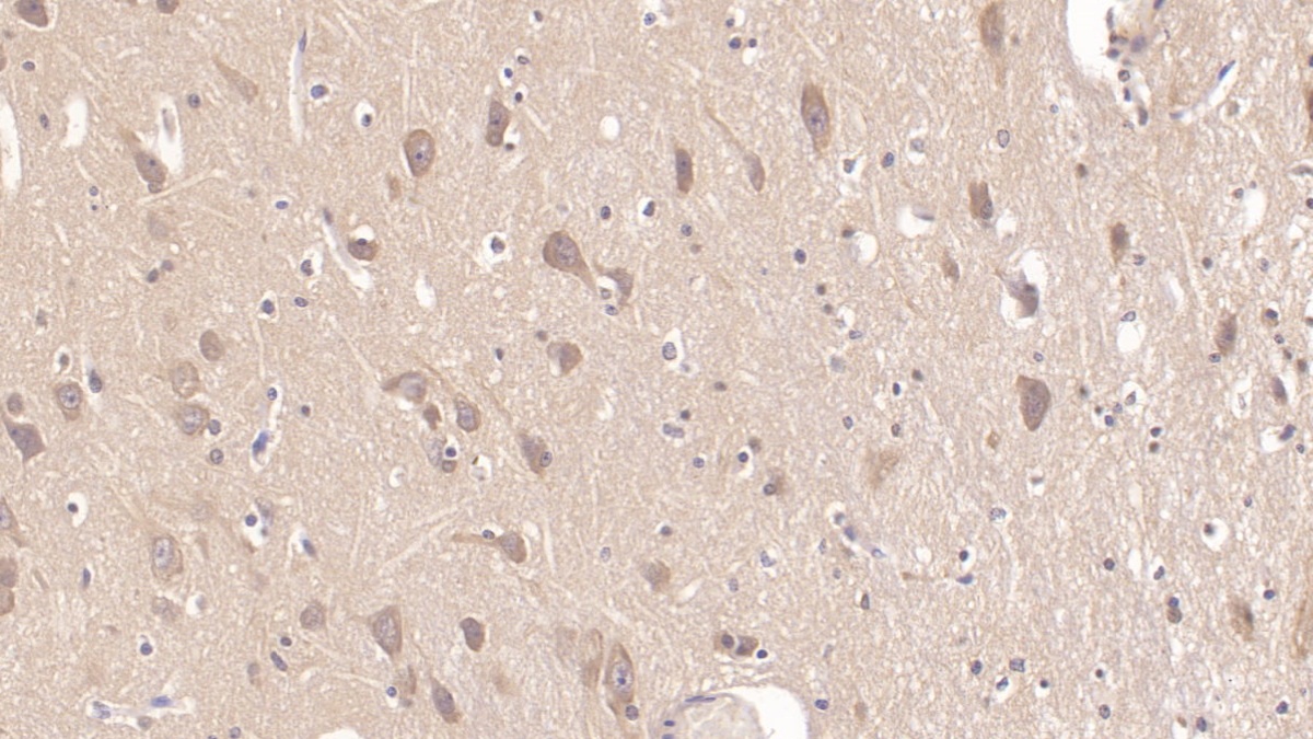 Monoclonal Antibody to Matrix Metalloproteinase 25 (MMP25)