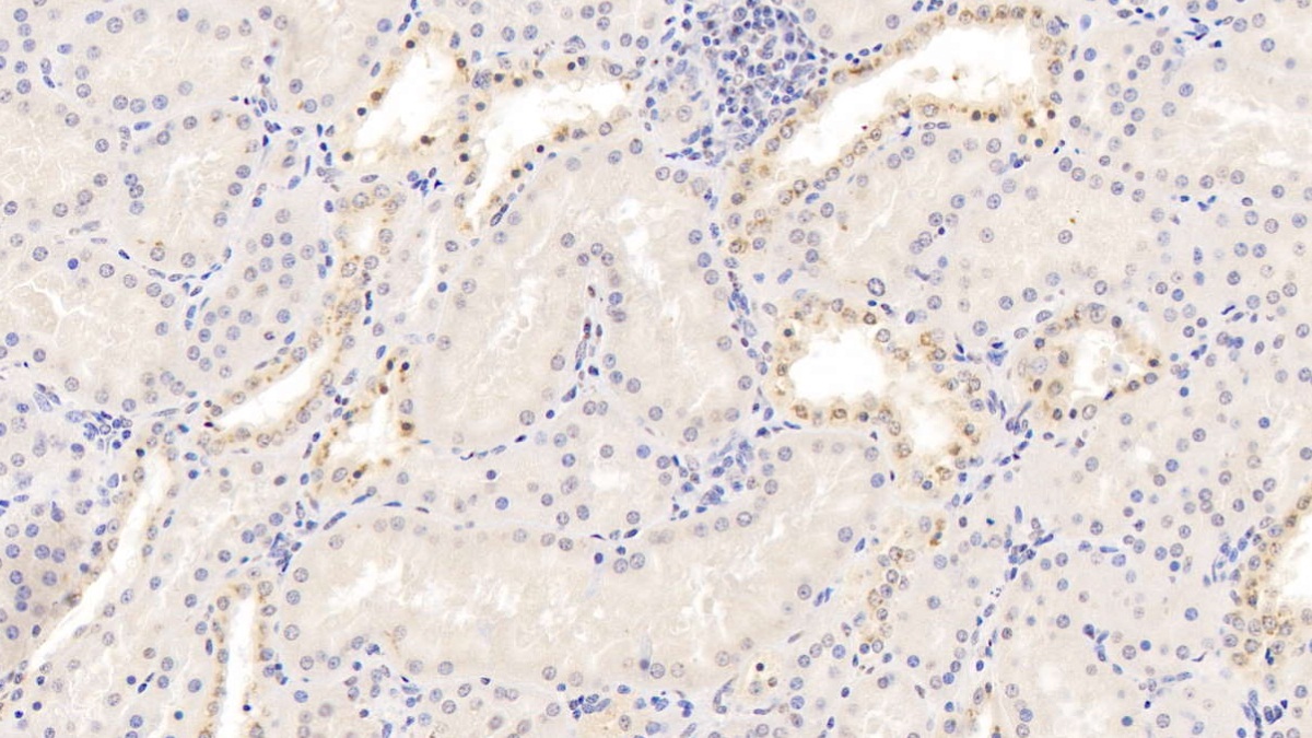 Monoclonal Antibody to Monokine Induced By Interferon Gamma (MIg)