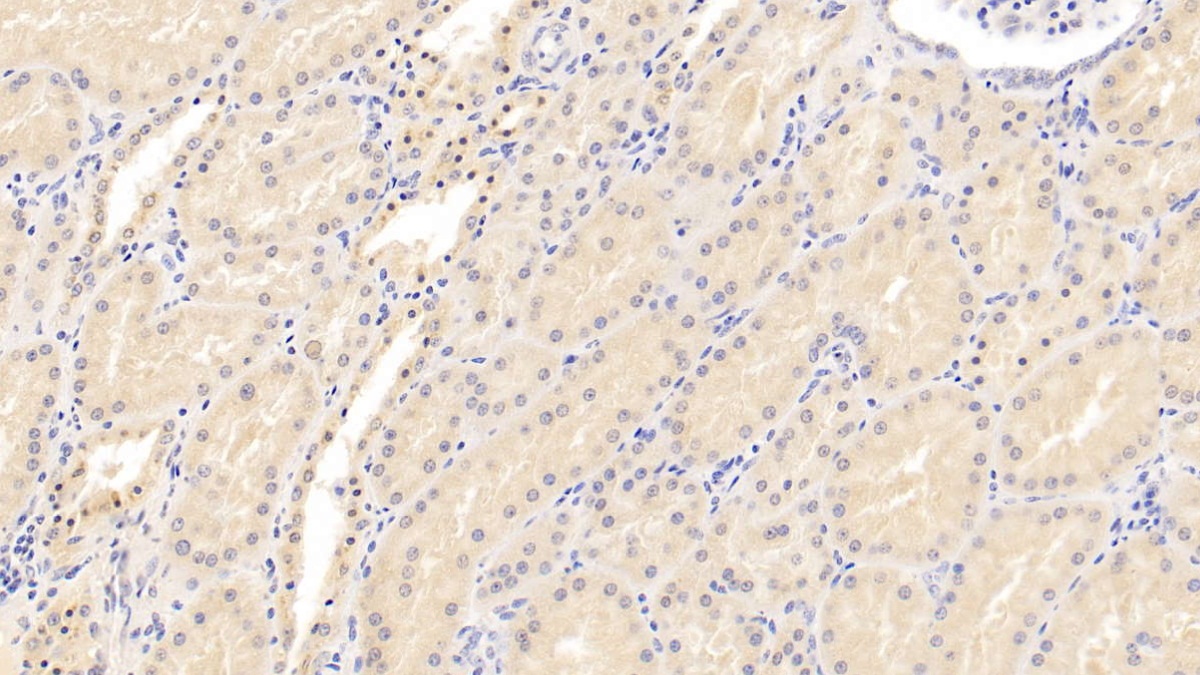 Monoclonal Antibody to Monokine Induced By Interferon Gamma (MIg)