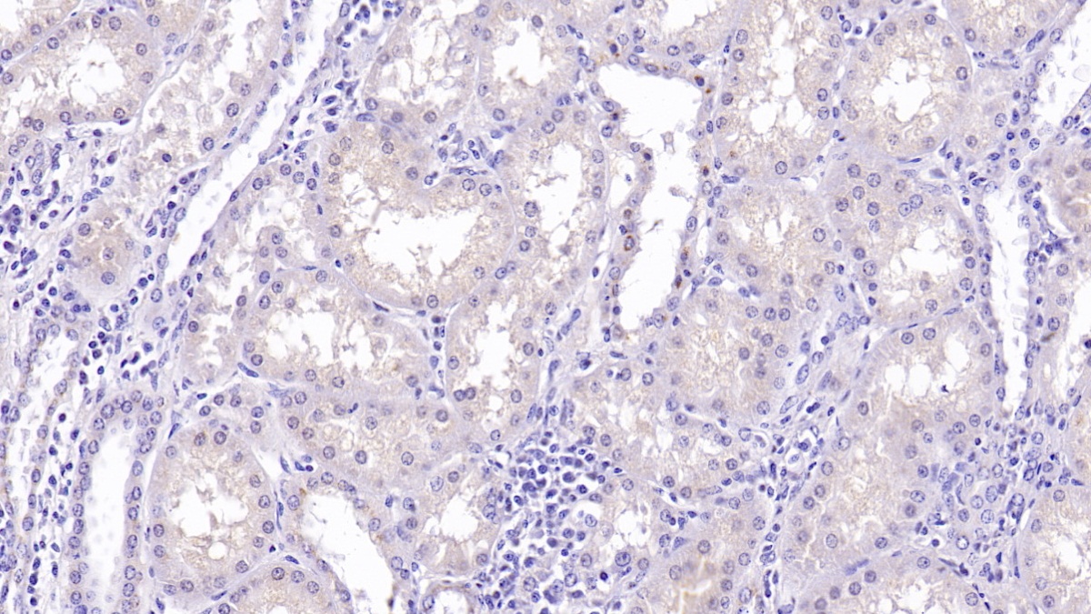 Monoclonal Antibody to Monokine Induced By Interferon Gamma (MIg)