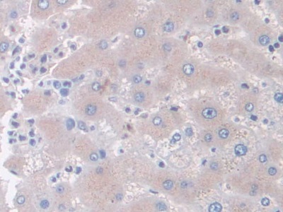 Monoclonal Antibody to Apotransferrin (apoTf)