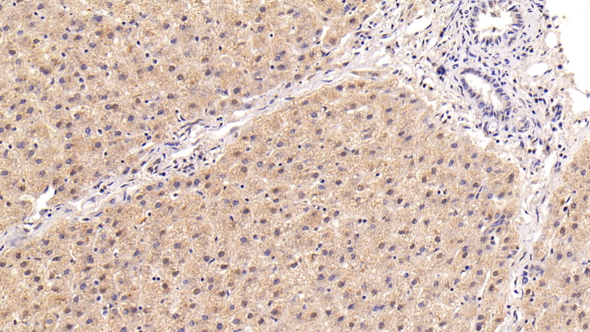 Monoclonal Antibody to Leucine Rich Alpha-2-Glycoprotein 1 (LRG1)