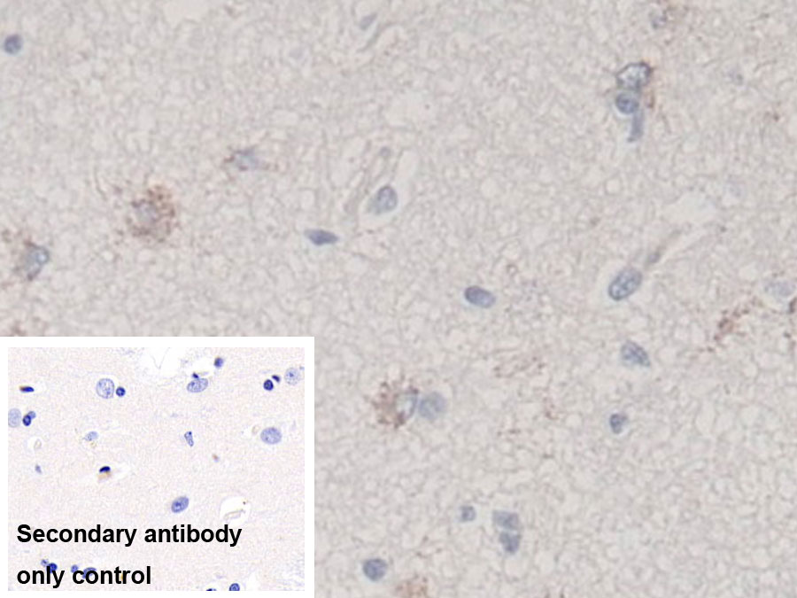 Monoclonal Antibody to Transforming Growth Factor Beta 3 (TGFb3)