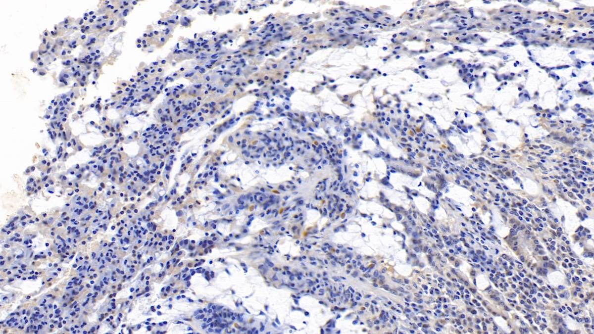 Monoclonal Antibody to Interleukin 17F (IL17F)