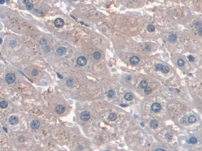 Monoclonal Antibody to Cluster Of Differentiation 34 (CD34)