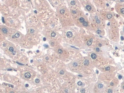 Monoclonal Antibody to Cluster Of Differentiation 34 (CD34)