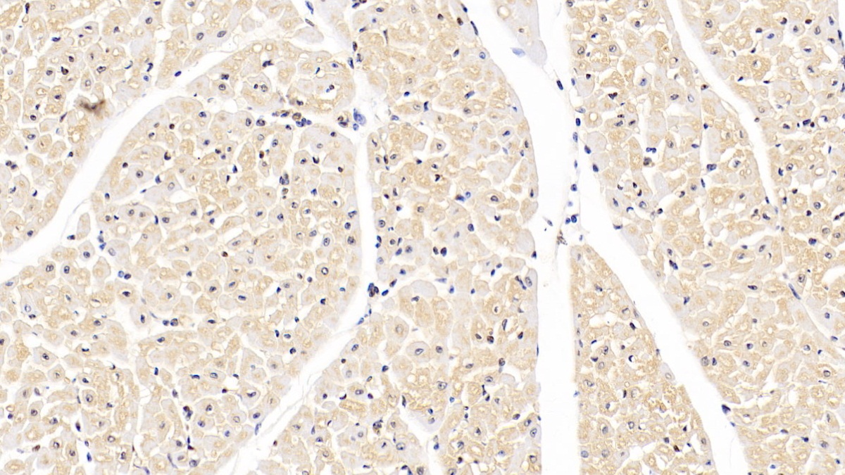 Monoclonal Antibody to Superoxide Dismutase 1 (SOD1)