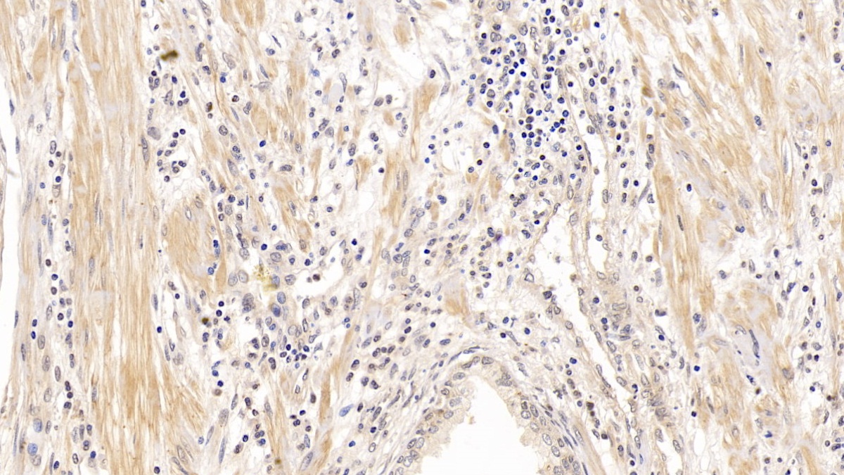 Monoclonal Antibody to Syndecan 1 (SDC1)