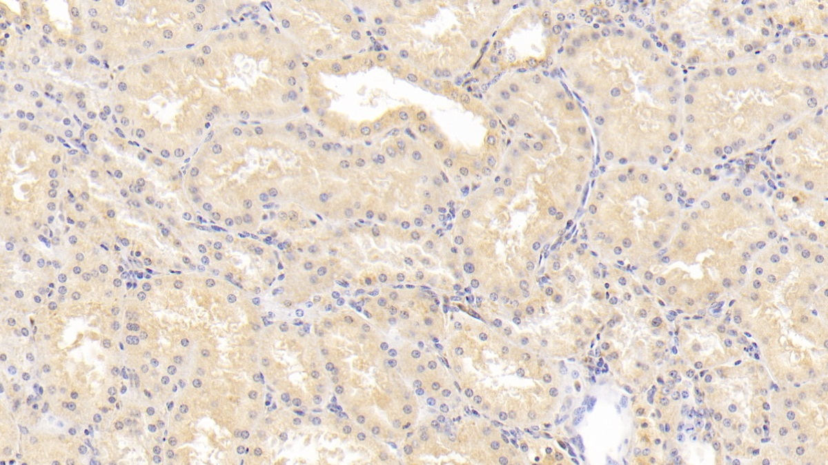 Monoclonal Antibody to Tenascin C (TNC)