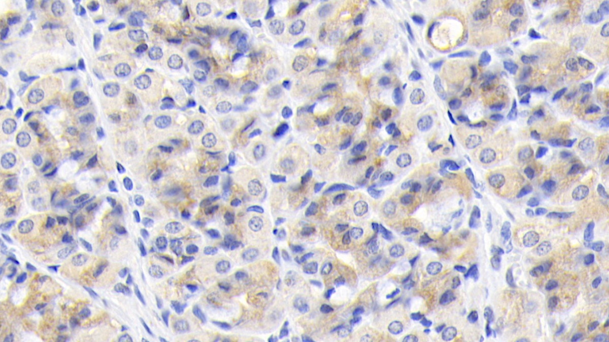 Monoclonal Antibody to Tenascin C (TNC)