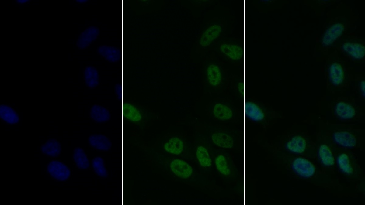 Monoclonal Antibody to Interleukin 33 (IL33)