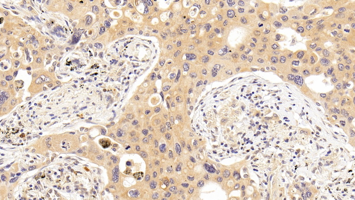 Monoclonal Antibody to Tau Protein (MAPT)