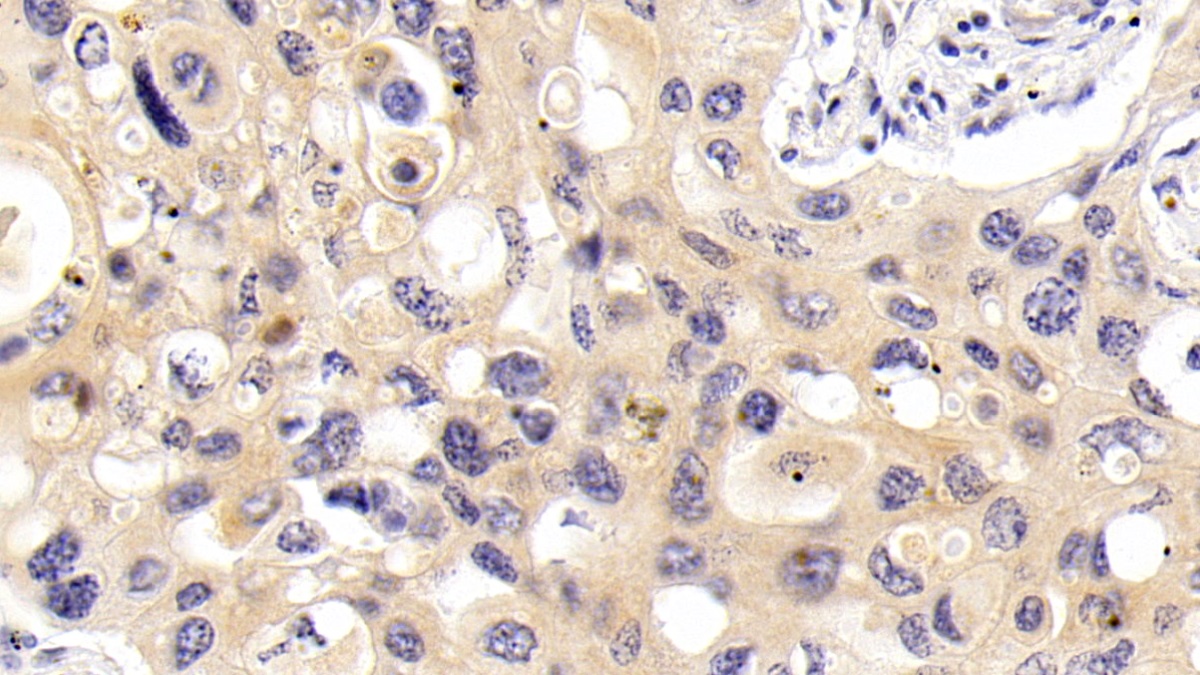 Monoclonal Antibody to Tau Protein (MAPT)