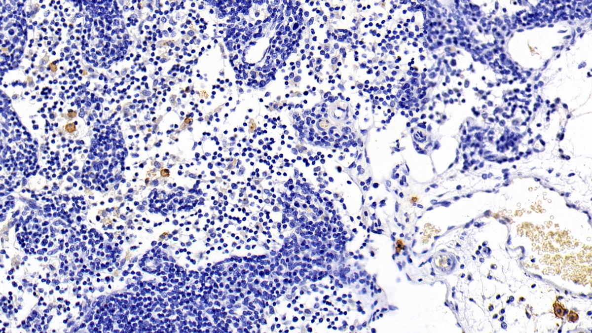 Monoclonal Antibody to Toll Like Receptor 5 (TLR5)