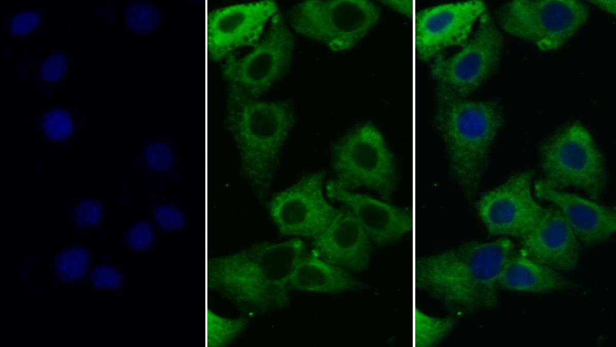 Monoclonal Antibody to Toll Like Receptor 8 (TLR8)