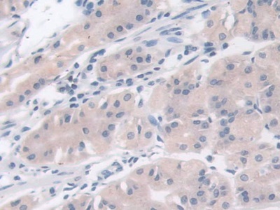 Monoclonal Antibody to Hemojuvelin (HJV)